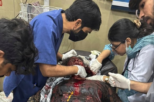 EDS NOTE: GRAPHIC CONTENT - In this photo released by the Inter Services Public Relations, a woman injured in a suspected Indian missile attack, receives treatment at a hospital in Bahawalpur, Pakistan, May 7, 2025. (Inter Services Public Relations via AP)