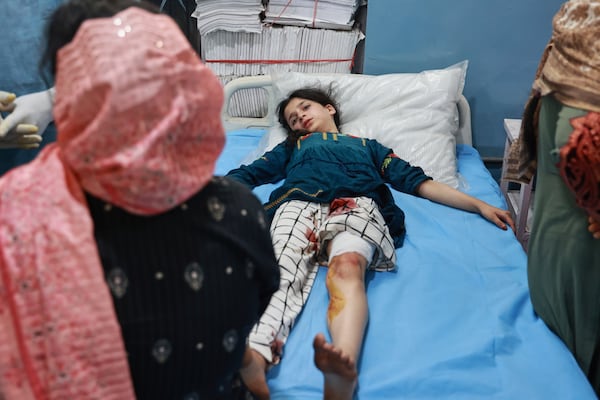A girl who lives in a village near the Line of Control between India and Pakistan, and was wounded during shelling by Pakistan is treated at a hospital in Uri, Indian controlled Kashmir, Wednesday, May 7, 2025. (AP Photo/Nasir Kachroo)