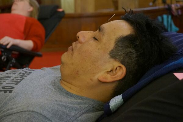 Juan Carlos Toapanta receives an acupuncture treatment in the sanctuary of St. Paul’s-San Pablo Lutheran Church, which recently added wellness sessions as part of its migrant ministry, in Minneapolis, Sunday, April 27, 2025. (AP Photo/Giovanna Dell’Orto)