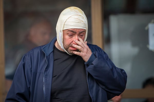 An injured man exits a hospital in the town of Kocani, North Macedonia, Sunday, March 16, 2025, following a massive fire in a nightclub early Sunday. (AP Photo/Visar Kryeziu)